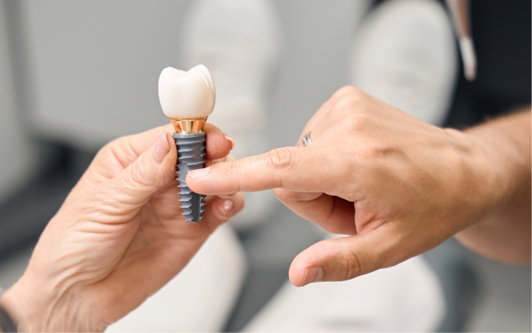 Implant dentaire